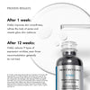 skinceuticals p tiox-skinceuticals canada-proven results
