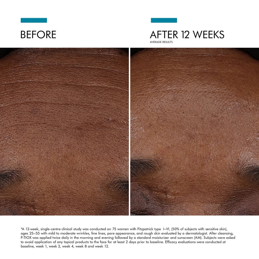 p tiox before and after-skinceuticals p tiox-skinceuticals canada